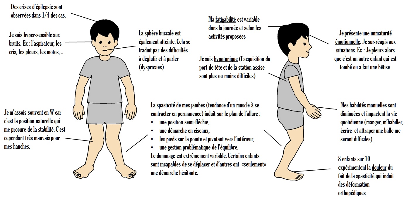 Paralysie Cerebrale Les Symptomes Enorev