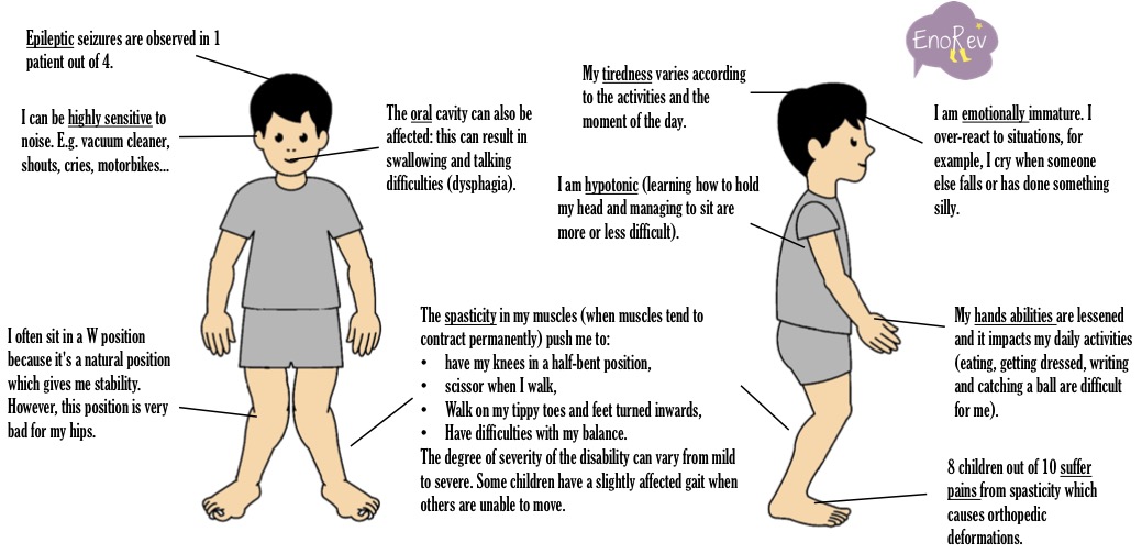 cerebral-palsy-the-symptoms-enorev